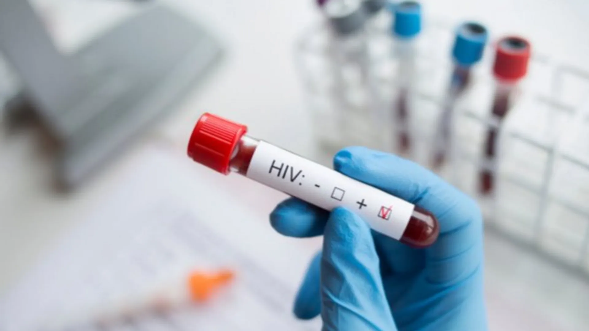 Zimbabwe becomes first country in Africa to approve HIV prevention drug