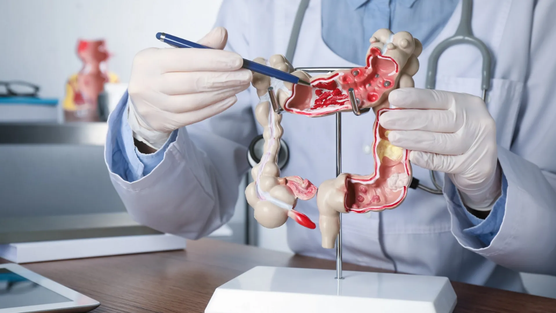 Constipation, other stomach troubles, may have a link with Parkinson's disease, says study
