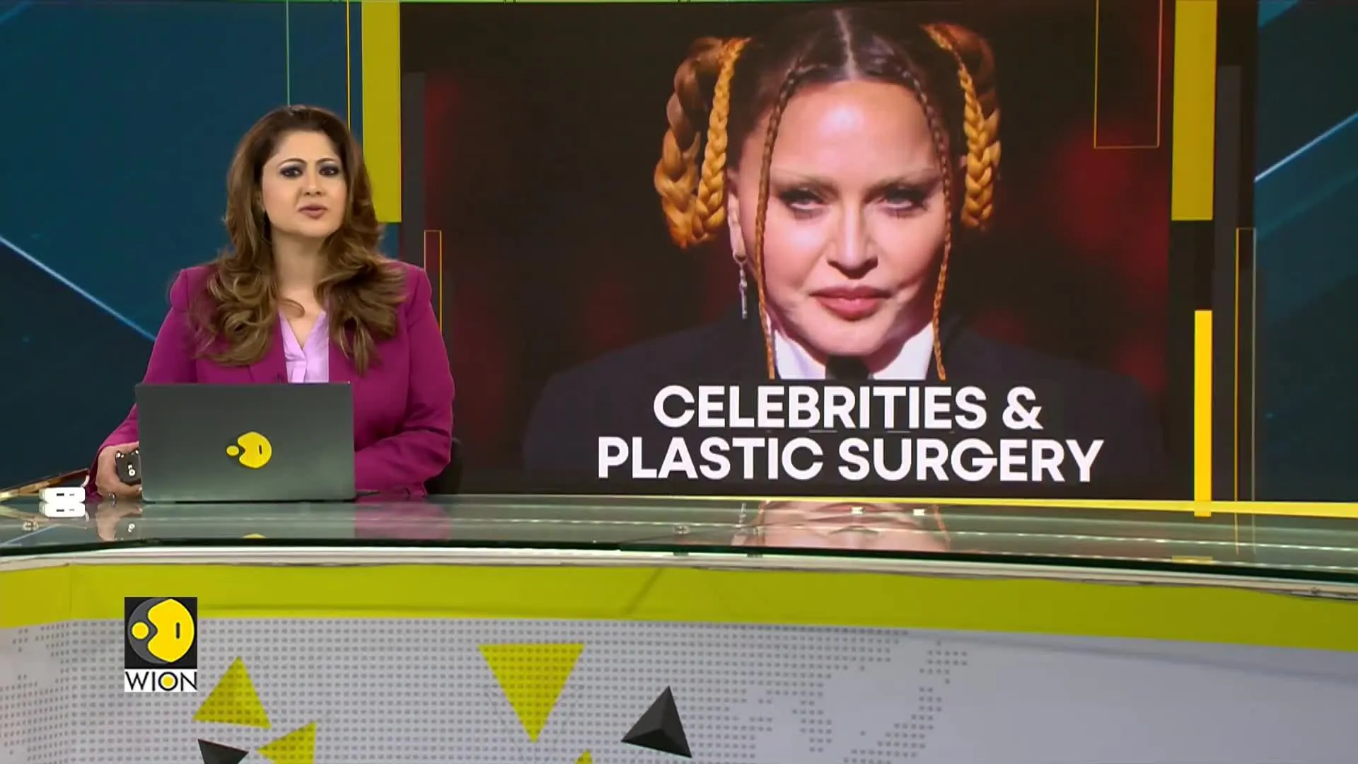 Madonna opens up about her plastic surgery
