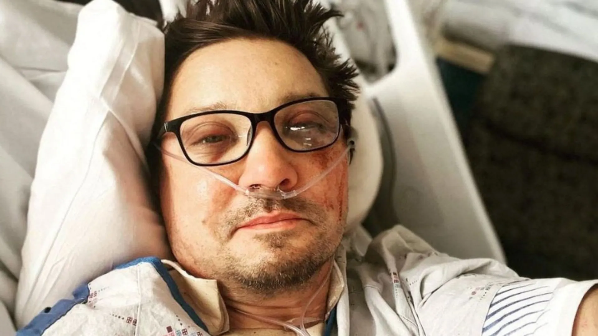 Jeremy Renner injury News - Latest Jeremy Renner injury News, Breaking