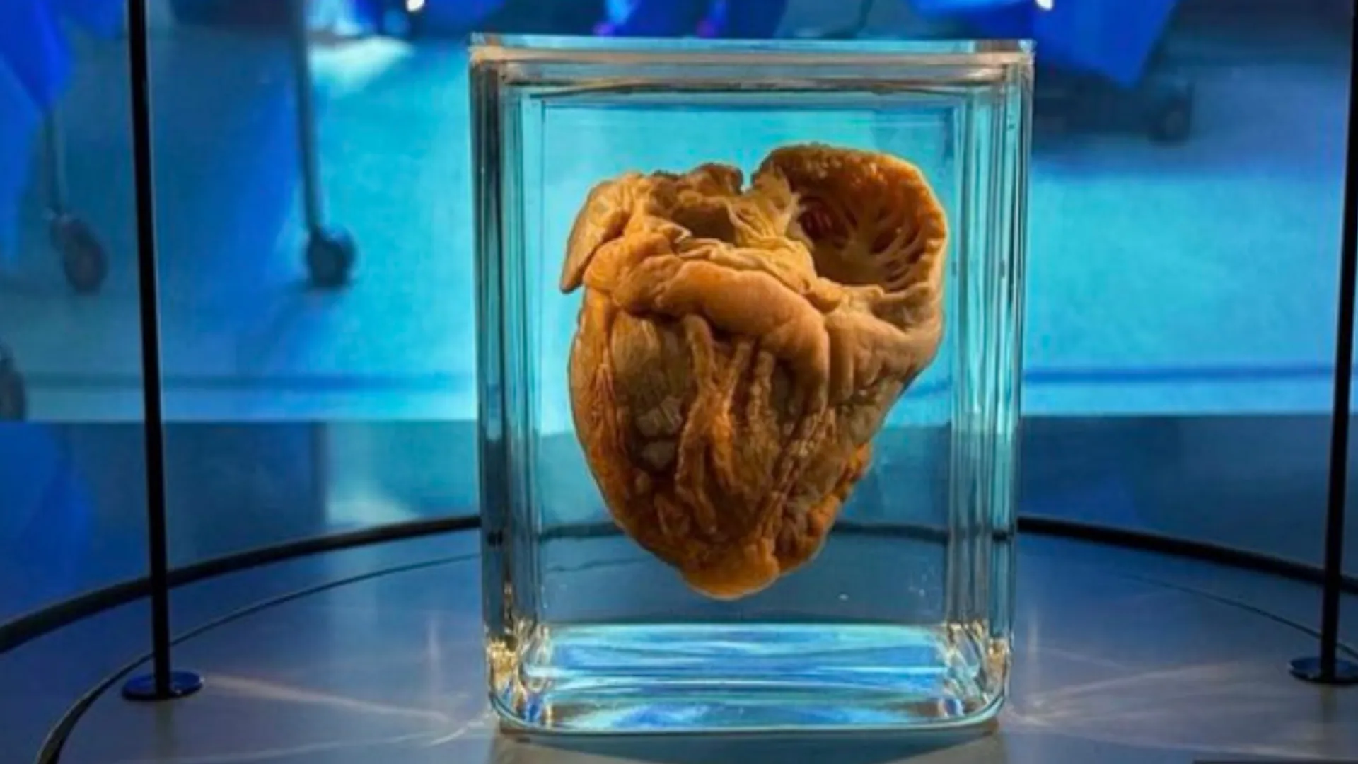 After 16 years, woman visits museum to see her own heart on display