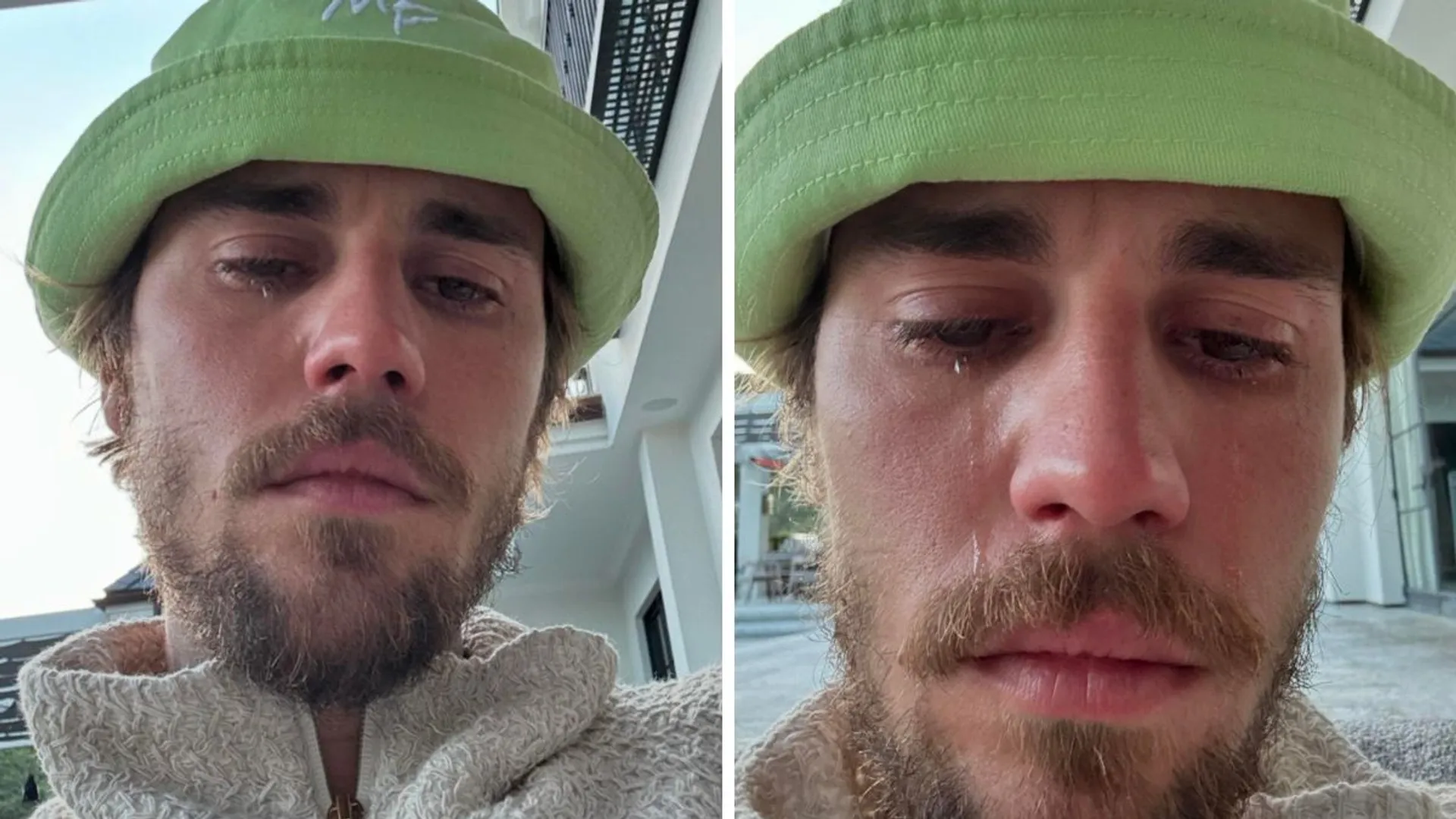Justin Bieber cries in candid selfies; fans worried, wife Hailey Bieber reacts