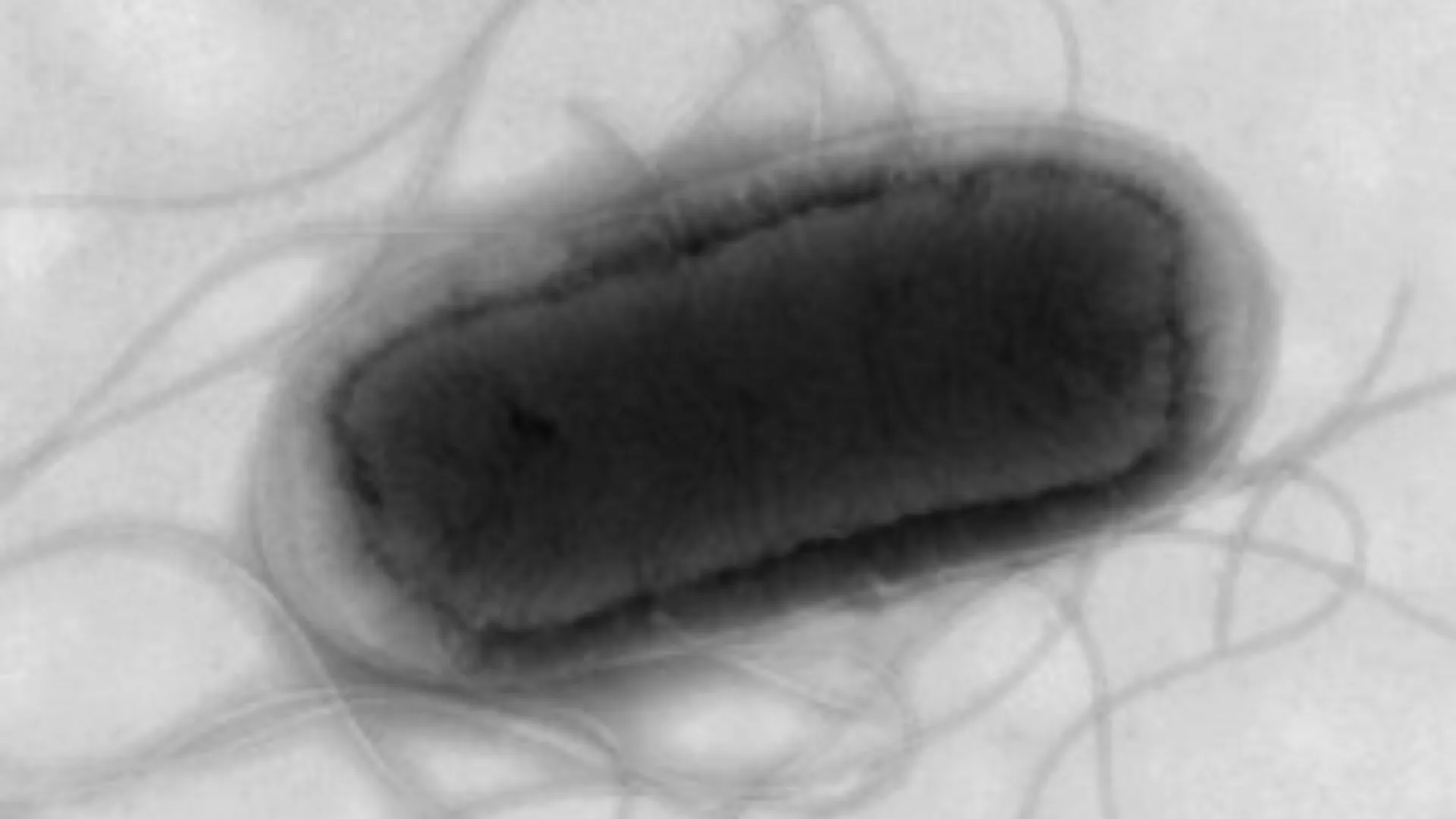 Health crisis in UK: Over 100 ill following E coli outbreak, says UKHSA