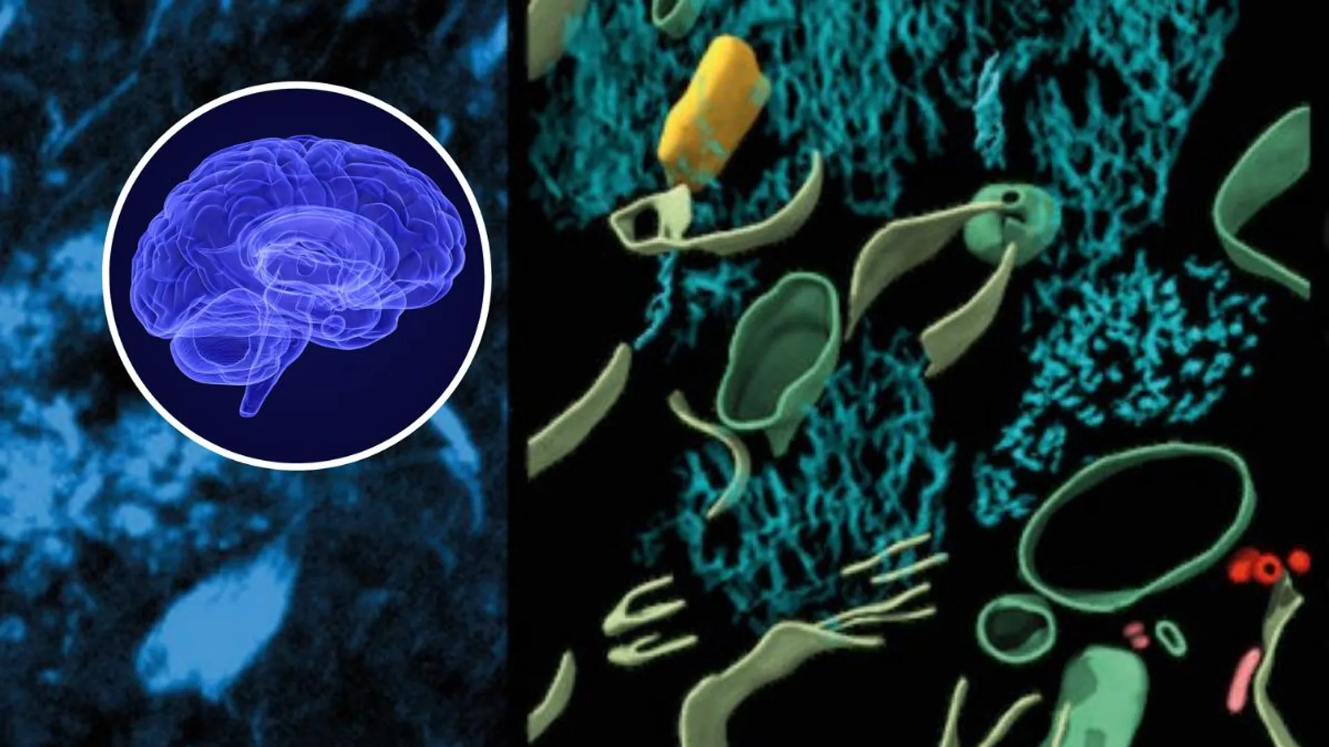 A deep look inside Alzheimer's brain: Molecule structure of proteins unveiled for first time