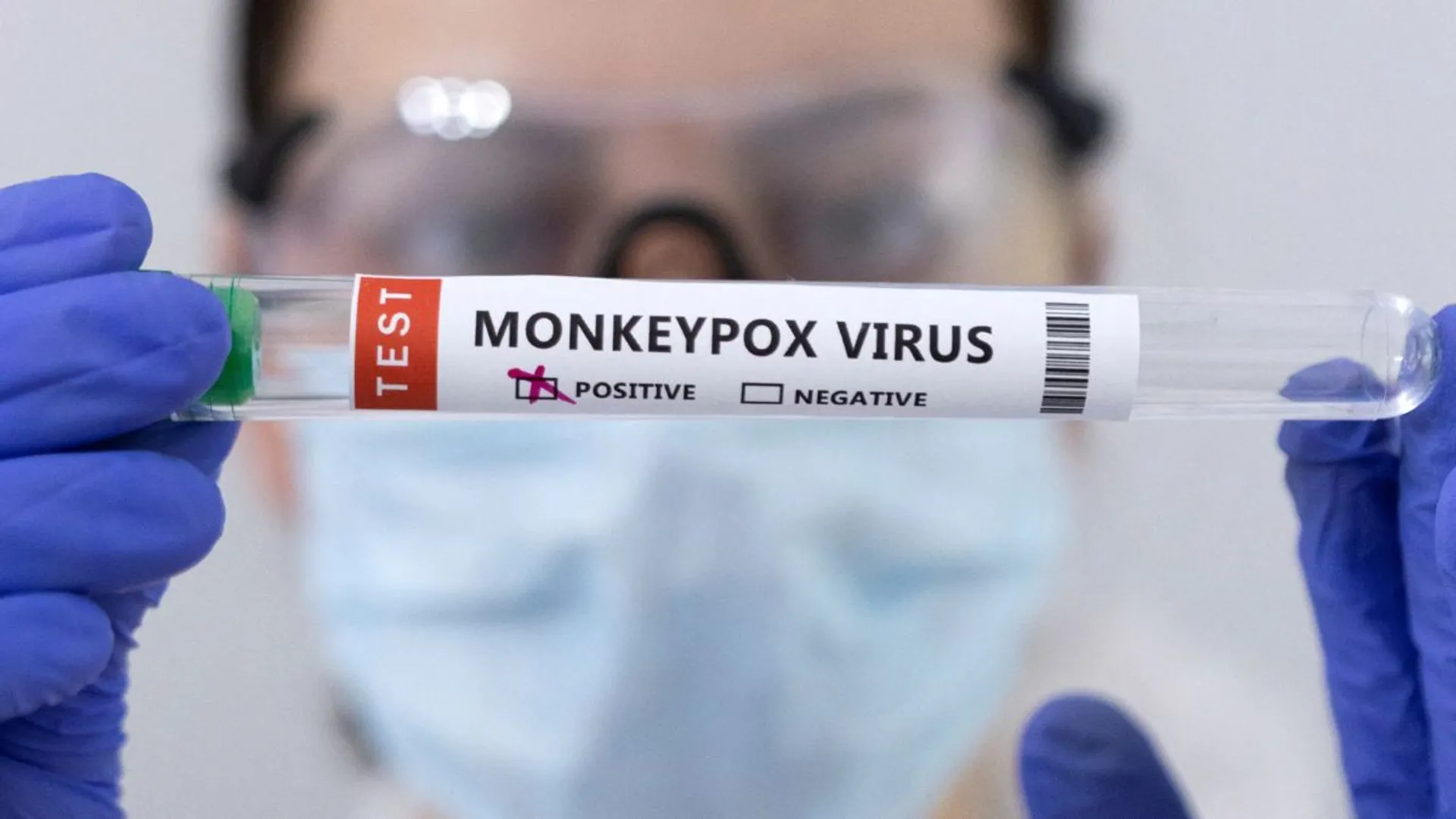 India: First case of mpox Clade 1b strain detected in Kerala