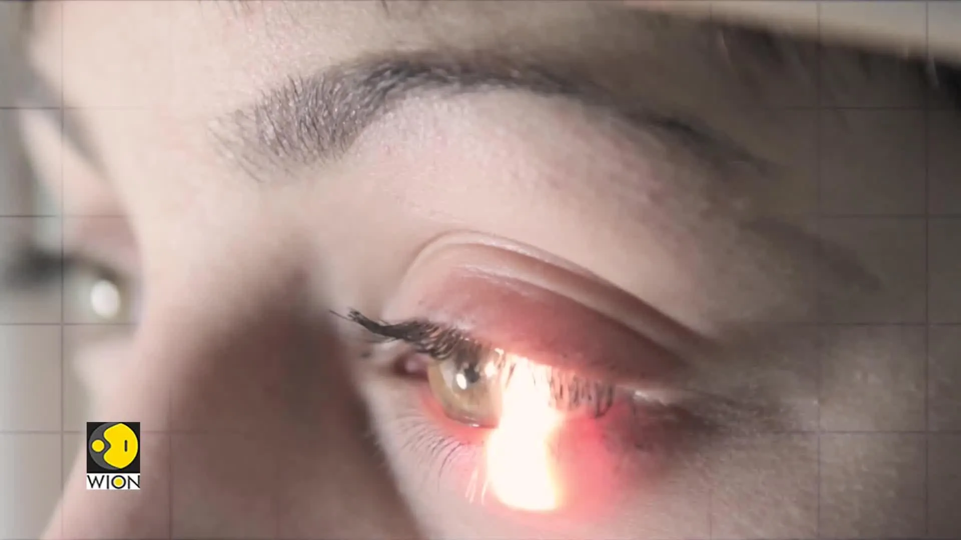 Detect disease with your eyes and new tech