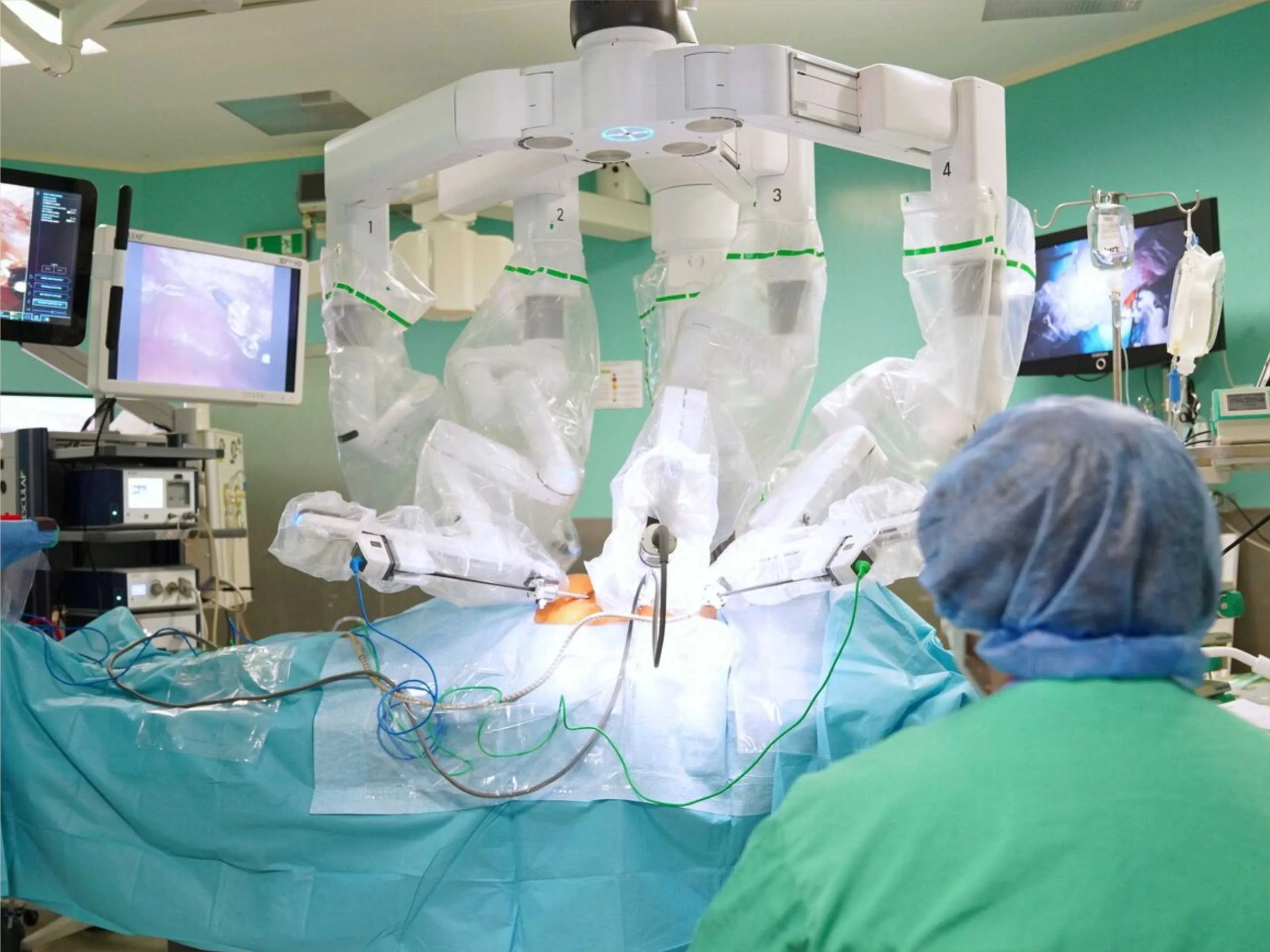 robots doing surgery