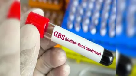 Guillain-Barre Syndrome, GBS Death, Guillain-Barre Syndrome Latest Cases, Guillain-Barre Syndrome cases in Mumbai, GBS vaccine availability, 