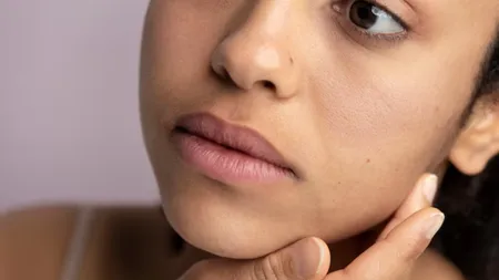dry skin 1 