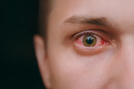 human eye 