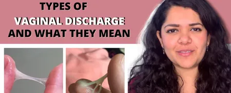 Vagina வெளியேற்றத்தின் நிறம் என்ன குறிக்கிறது?