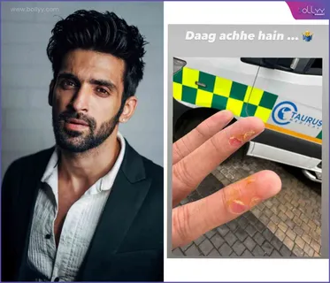 While performing stunts, Arjit Taneja hurts his fingers; Actor shares picture on his social media