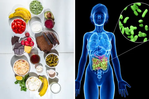 Explore Probiotics and Fermented Foods as Gut Healing Superfoods