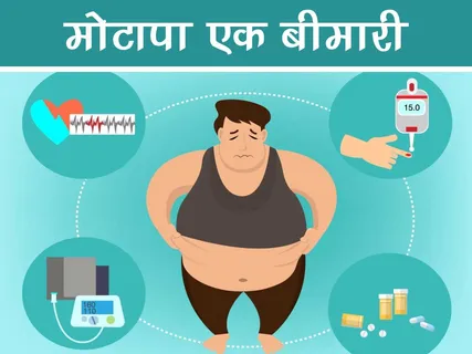 Health: मोटापा एक बीमारी