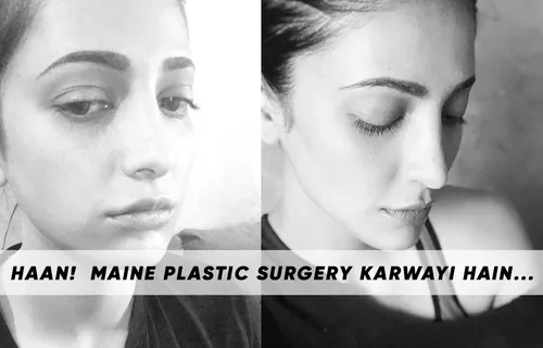 Plastic Surgery पर ट्रोल हो रही एक्ट्रेस ''Shruti Haasan'' ने दिया करारा जवाब