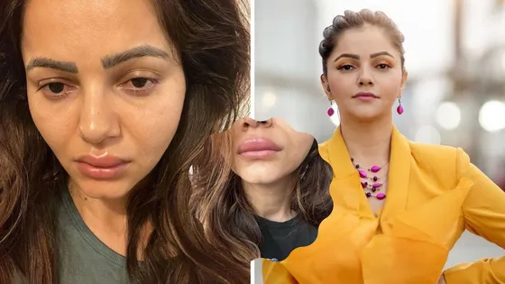 Rubina Dilaik Face: आखिर किस कारण हुआ Rubina Dilaik का चेहरा, जाने इसके पीछे की वजह