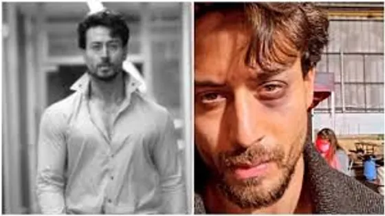 Tiger shroff suffers eye injury while shooting for Ganapath in UK , shares pic !