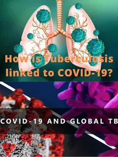 Tuberculosis due to Covid : This is the Painful Treatment for Tuberculosis if Cough Persists :