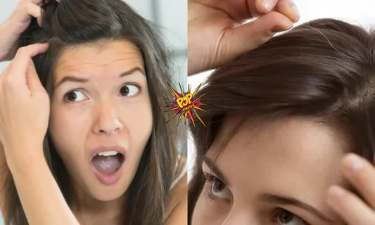 Are Your Hairs Turning Grey? Don't Worry, Do These Quick Solutions