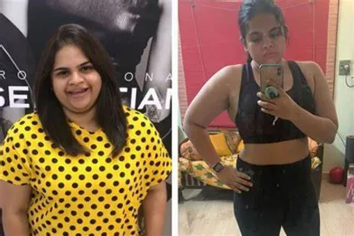 19-Year-Old Dies During Weight Loss Surgery, Tamil Nadu Government Orders Probe