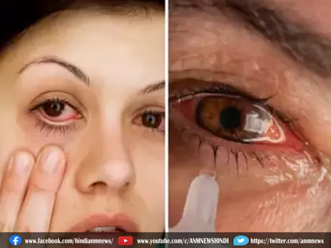 Eye Flu बढ़ने से काले चश्मे की बिक्री में 25 फीसदी इजाफा