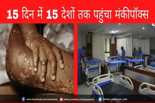 15 दिन में 15 देशों में फैला मंकीपॉक्स वायरस