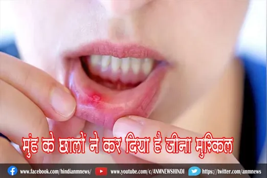 मुंह के छालों ने कर दिया है जीना मुश्किल