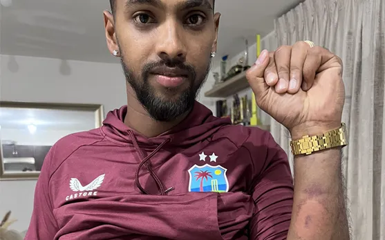 'Kash hamare batters aisa khelte' - Fans react to Nicholas Pooran's pictures showing his injuries after 5th T20I against West Indies