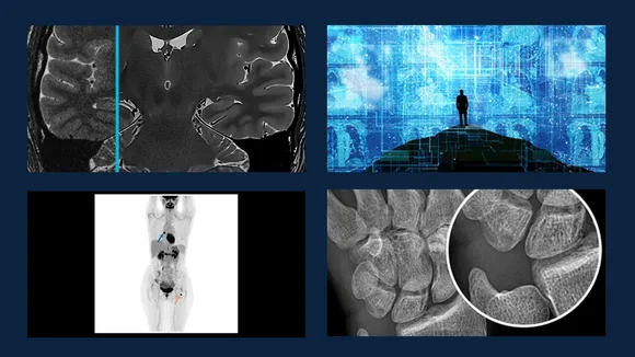 Revolutionizing Medical Imaging: The Rise of AI and Deep Learning