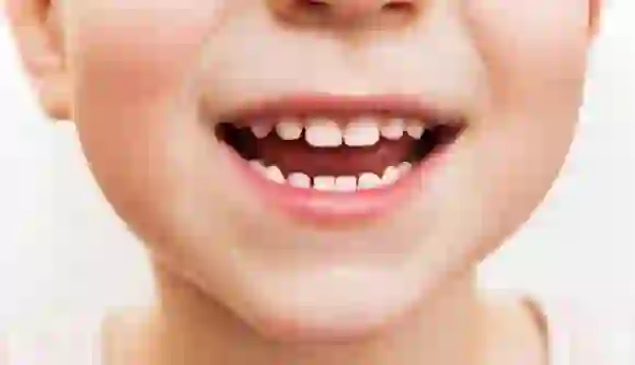 Parenting Tips: बच्चों के दांतों को स्वस्थ और मजबूत रखने के 5 टिप्स