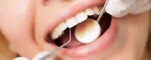 Teeth Care: दांतों की सुरक्षा है स्वास्थ्य की सुरक्षा