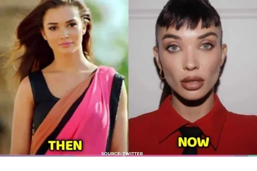 How did Amy Jackson's face change so much?