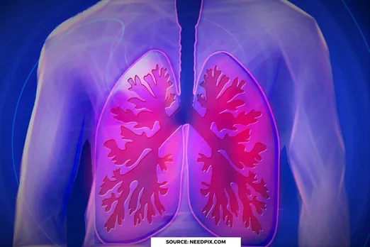 COPD: Smoking's deadly impact on 392 million lives worldwide