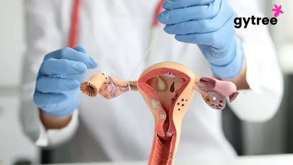 Can one get their Menstrual Periods after Tubectomy?