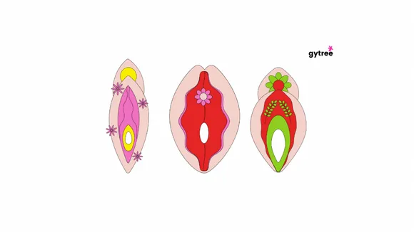 Does the vagina become loose after sex?