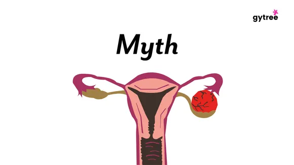 Stop believing these myths about PCOS!