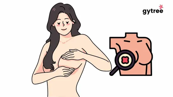 Self Breast Examination: Importance and Need in Indian Women!