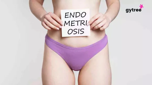 Treatments of Endometriosis 
