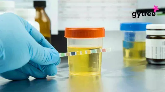 What your urine colour tells about your health?