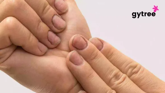 Nail health: What your nails tell about your health?