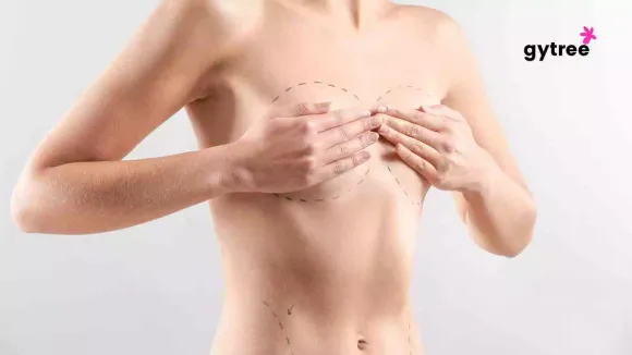 Double mastectomy: What is it?