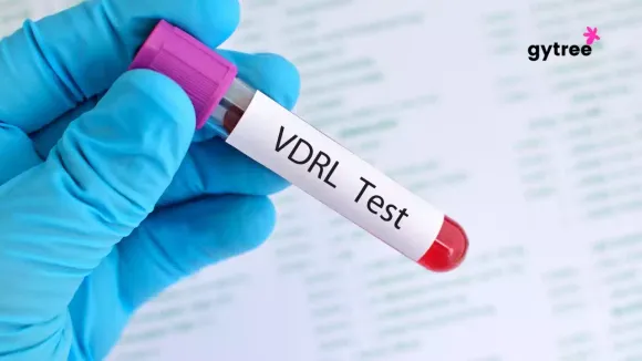 How to prepare for a VDRL test?