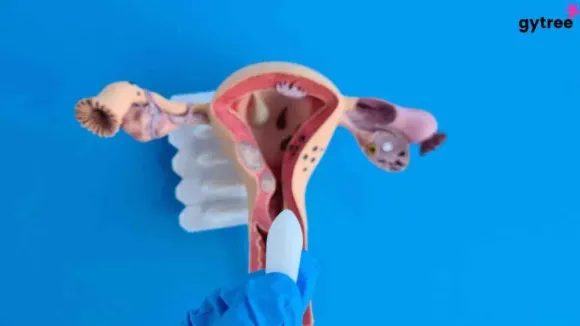 Reasons for Vaginal Dryness in Your 20s and 30s And Their Solutions