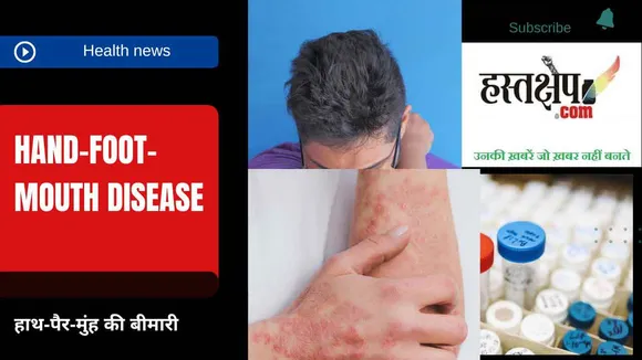 Hand Foot Mouth Disease in Hindi: क्या है हाथ-पैर-मुंह की बीमारी एचएफएमडी