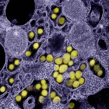 सतह पर काफी देर तक जिंदा रहता है नोवल कोरोना वायरस : शोध