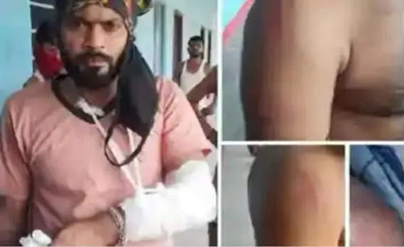 बिहार में क्वारंटाइन सेंटर में अनियमितता के खिलाफ आवाज उठाने पर मजदूरों की पिटाई, एक मजदूर का टूटा हाथ