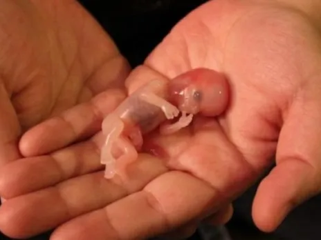 Miscarriage: गर्भपात होने पर महिलाओं को किन बातों का ध्यान रखना चाहिए