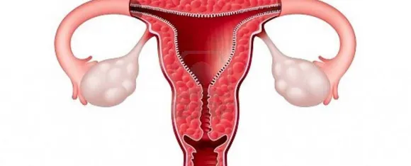 Vaginitis Causes : वैजिनाइटिस क्या है और वैजिनाइटिस क्यों होता है