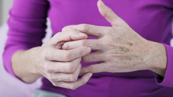 Arthritis