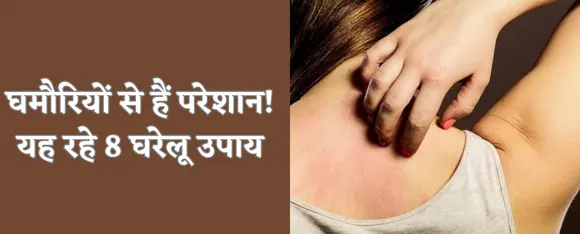 जानिए घमौरियों से छुटकारा पाने के लिए 8 घरेलू उपाय